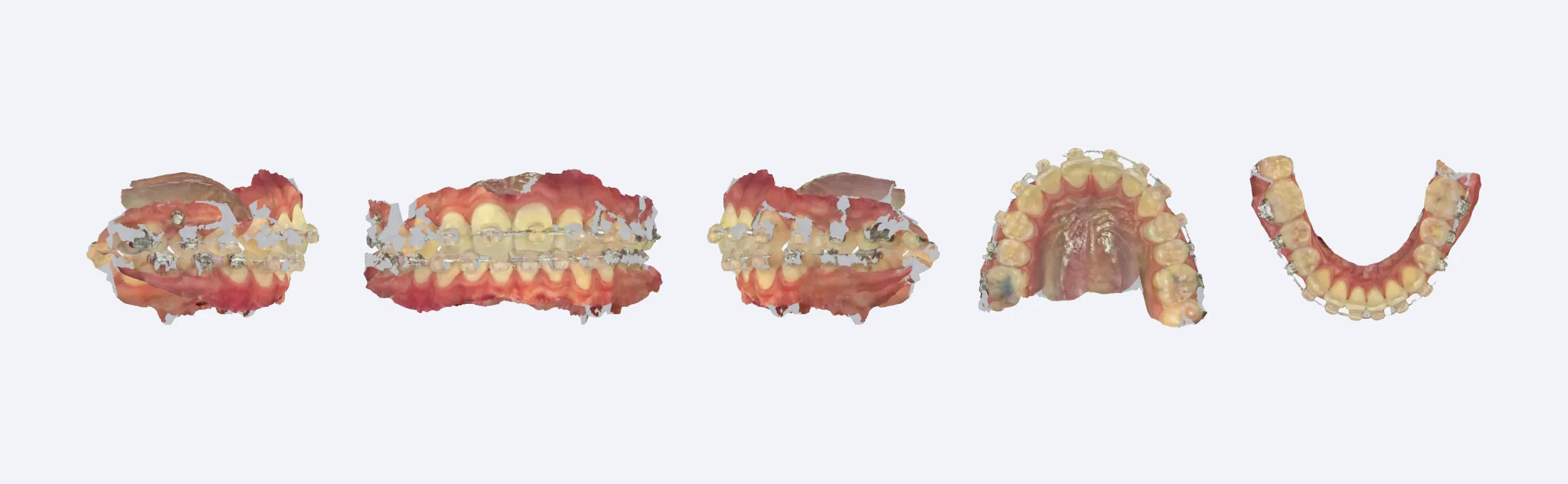 fixed-retainer