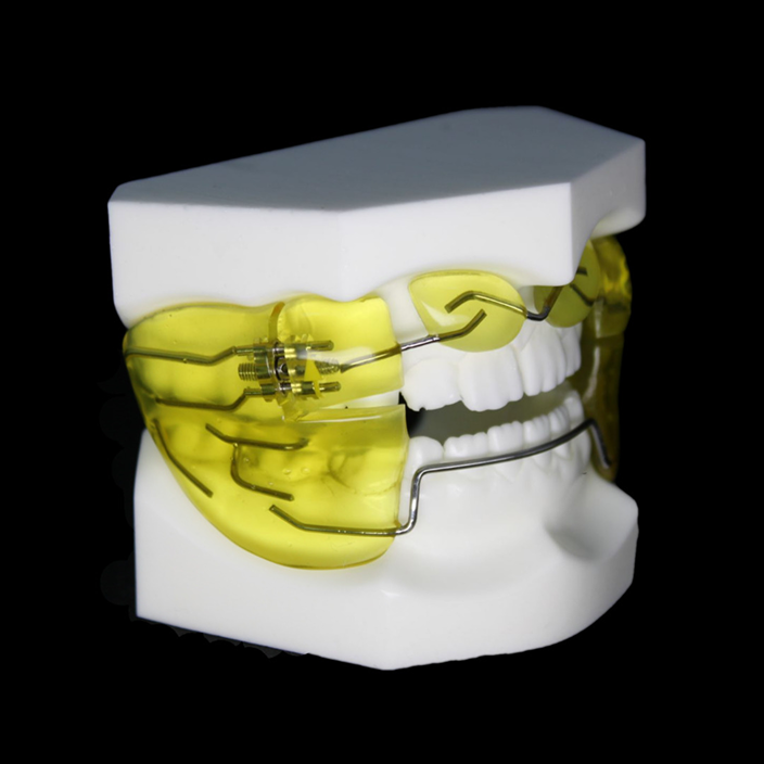 fixed appliance