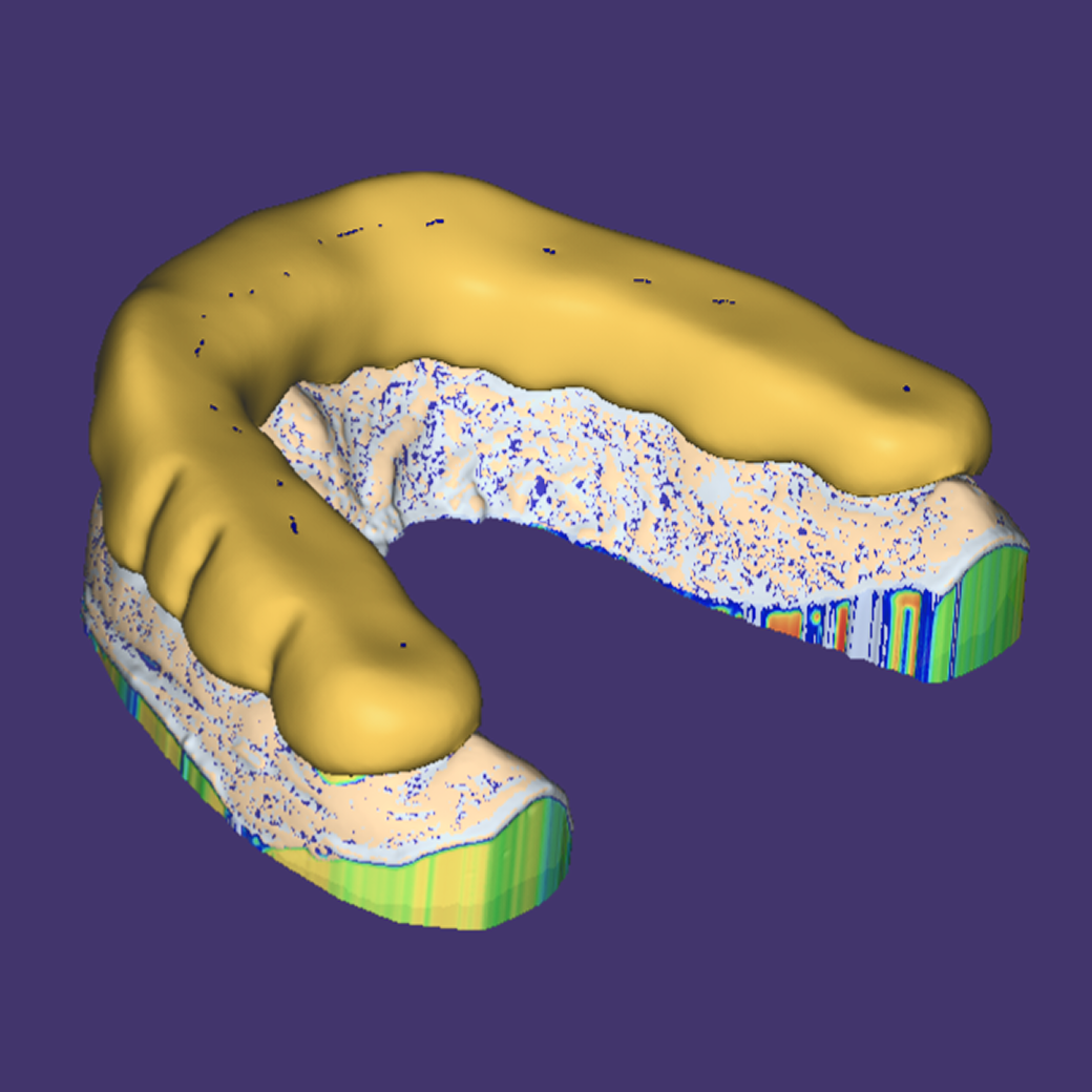thermo splint